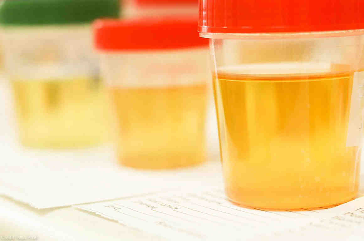 Trump s Labor Department Wants To Drug Test Applicants For Unemployment 