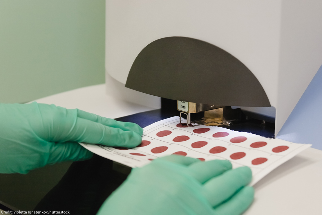 Newborn blood samples being prepared for analysis.